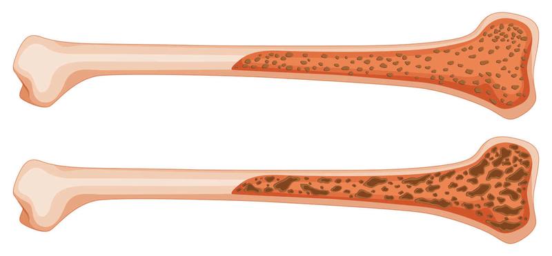 Ochrona kości podczas treningu