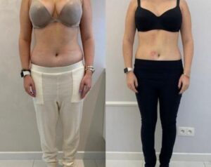 Odkryj skuteczne metody na odchudzanie brzucha: dieta i styl życia w harmonii ze sobą